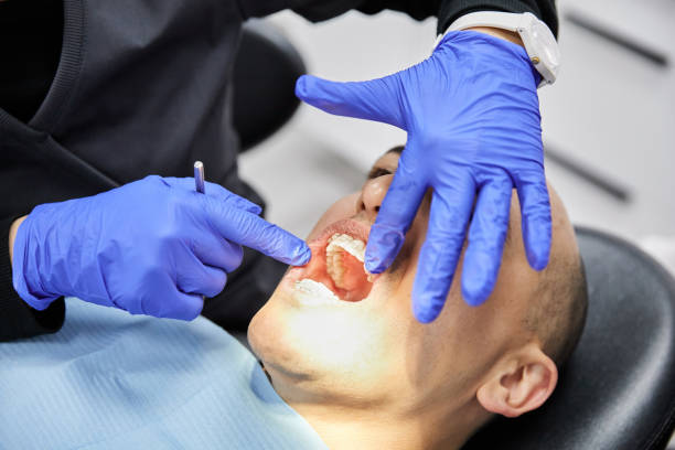 Best Emergency Dentist for Knocked-Out Tooth in Brawley, CA